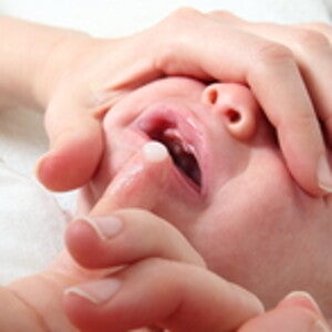 Muguet buccal : signes et remèdes