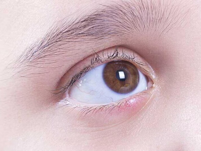 عين