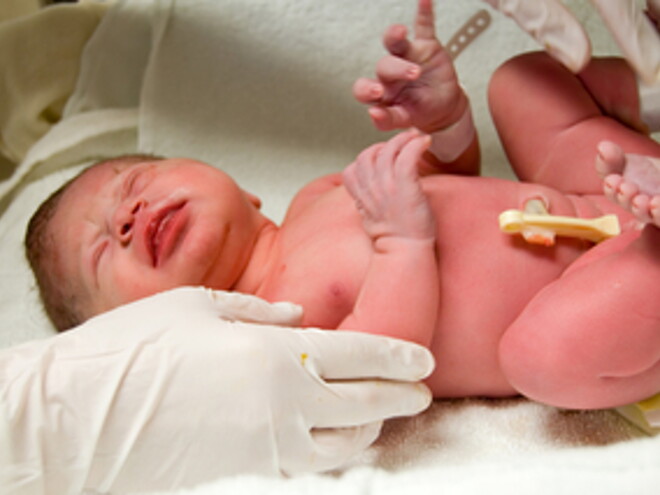 Cutting The Umbilical Cord Cutting The Umbilical Cord