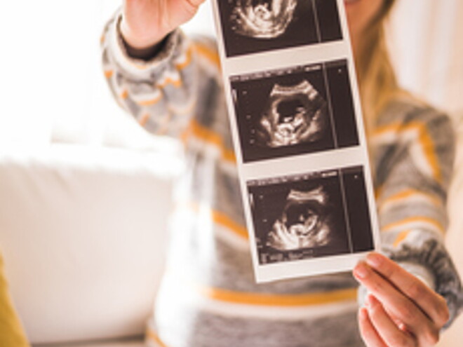 Questions to ask at your 12-week scan Questions to ask at your 12-week scan